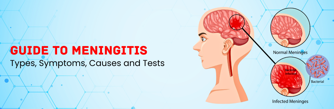 Guide to Meningitis: What are the Types, Symptoms, Causes and Tests